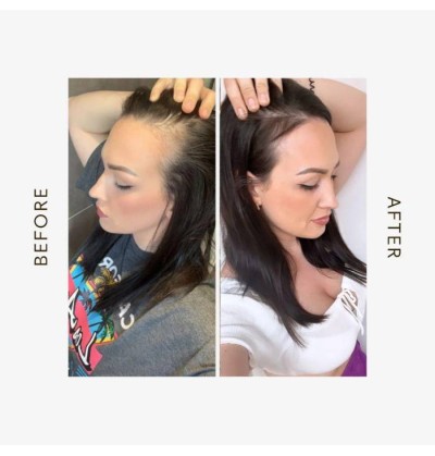 Masken gegen Haarausfall & Haarwuchs - MakeMyMask
