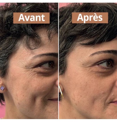 Sérum visage anti-âge