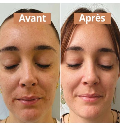 Sérum visage purifiant