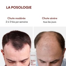 Sérum Anti-Chute Tricho-Boost - MakeMyMask